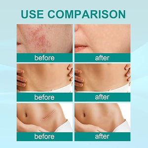South Moon Scar Spray